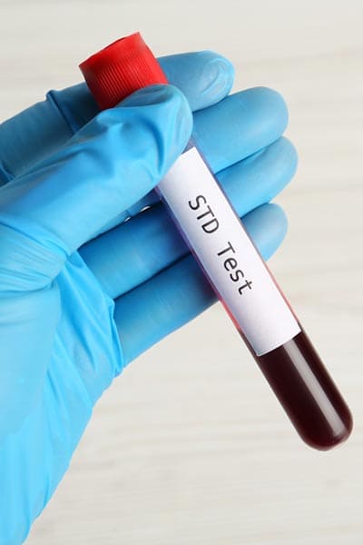 STD Testing