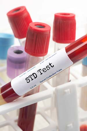 STD Testing Near Me in Asheboro, NC